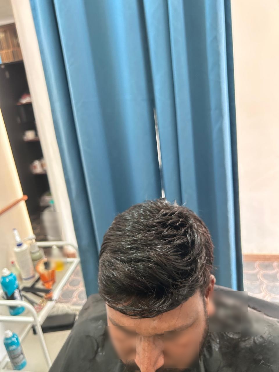 Hair Bonding for Men